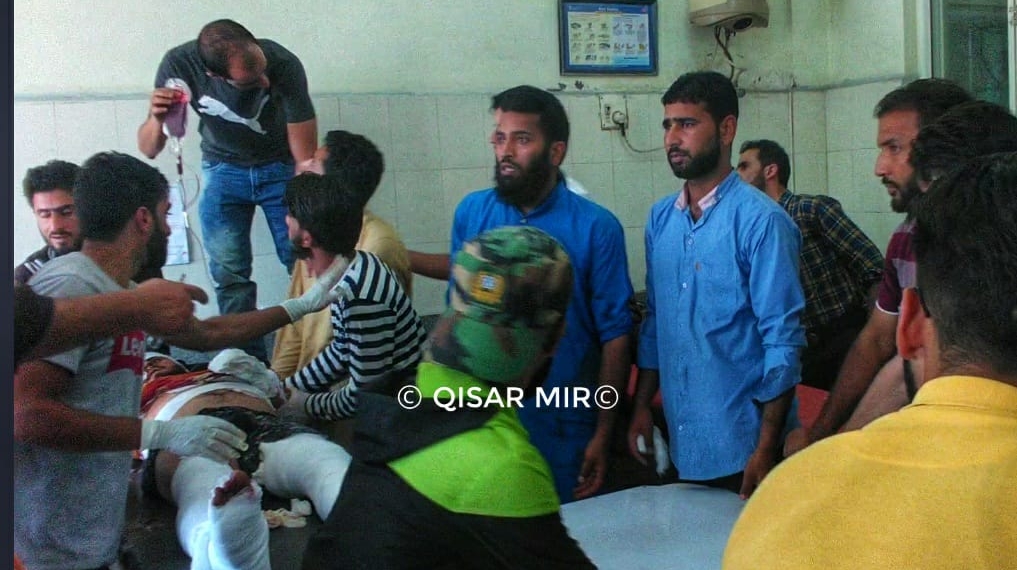 Youth injured in mysterious blast at Pulwama