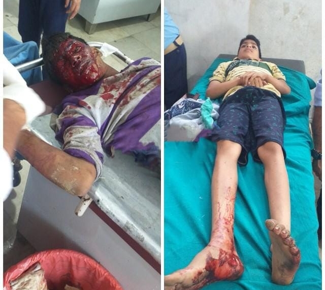 Mysterious blast in Kulgam two injured among one non-local critical