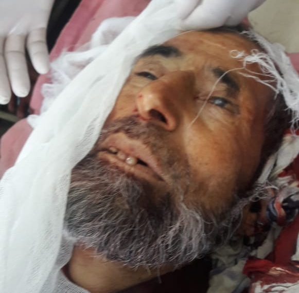 Old aged man dies in Sopore road Mishap