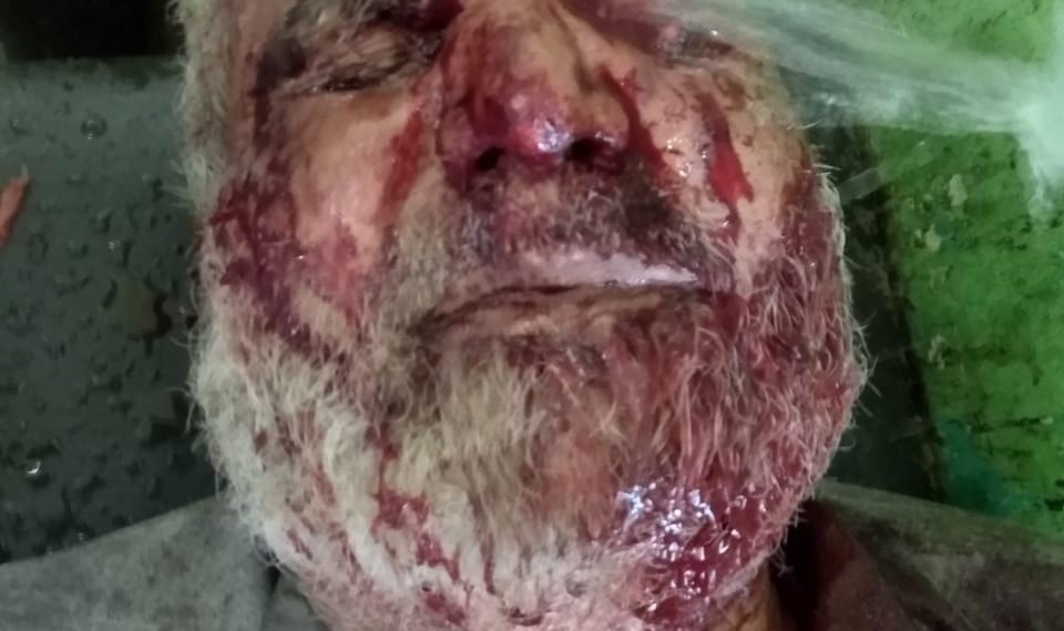 Man injured in bear attack in Handwara village