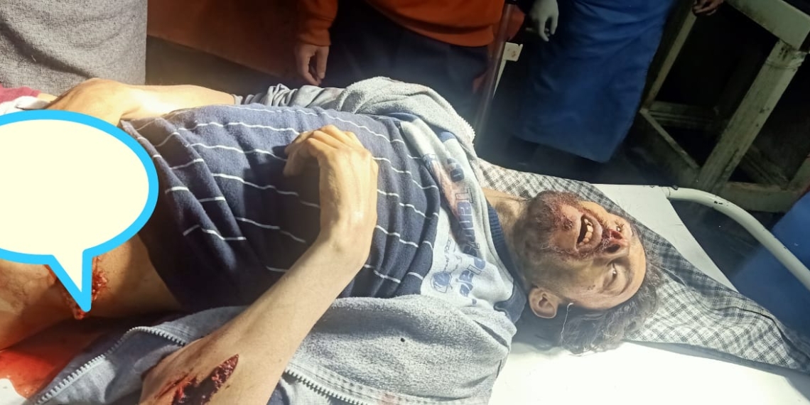 Suspected militants shot dead a man in South Kashmir
