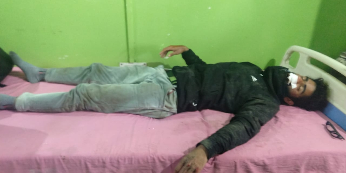 Sopore Journalist Injured in road mishap