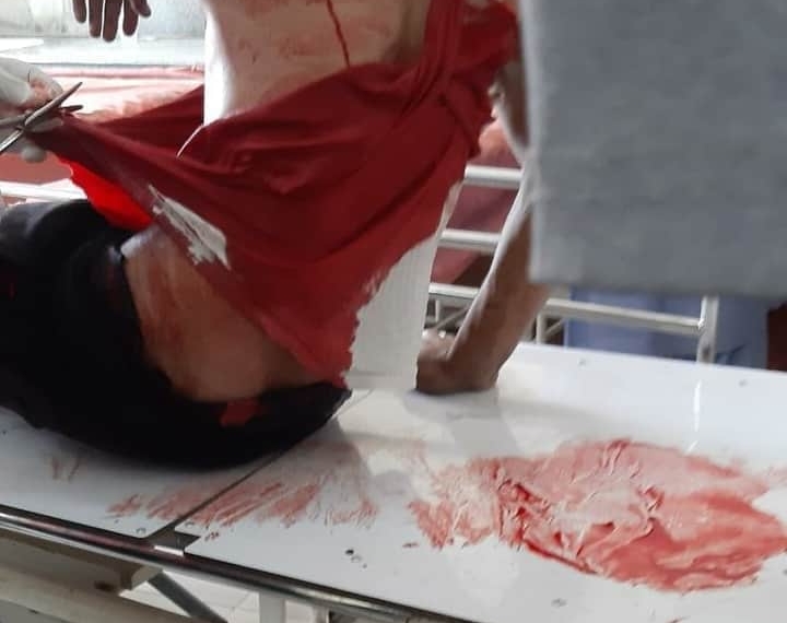 Unknown persons attack, injure youth in Pulwama, shifted to SMHS