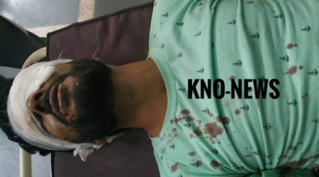 Youth injured after mobile explodes in his hands in Tral