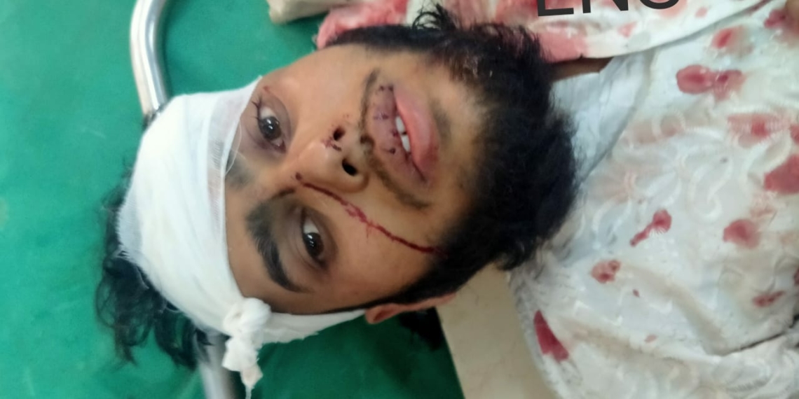 LoC flare-up: 3 civilians injured in Karnah Kupwara