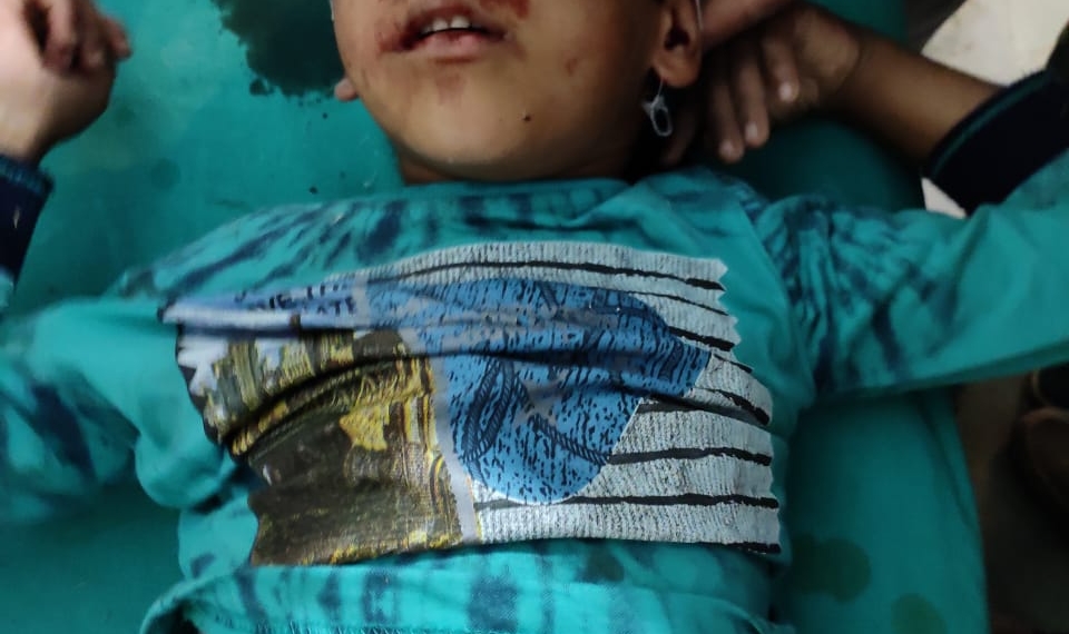 10-yr-old boy killed, his father injured in Sopore mishap