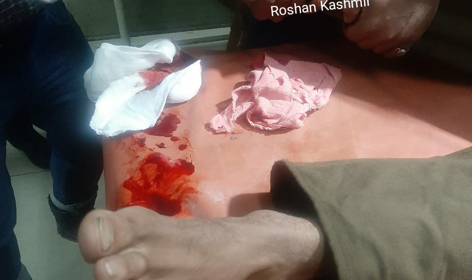 Army porter injured in landmine explosion in Tangdhar sector